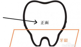正确刷牙方法视频教程,告别口腔问题