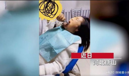 拔智齿视频,视频带你直观体验