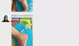 小针刀治疗视频,视频教学深度解读