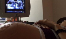 大肚子视频,揭秘肥胖背后的秘密与应对策略