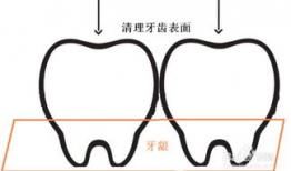 正确刷牙方法视频教程,告别口腔问题