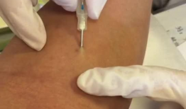 抽血视频,视频带你直观了解